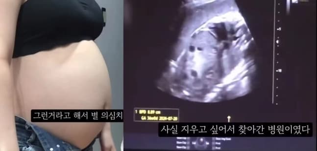 ‘36주차 낙태’ 의혹 20대, 떨고 있나…경찰 피의자 특정 나서 이미지