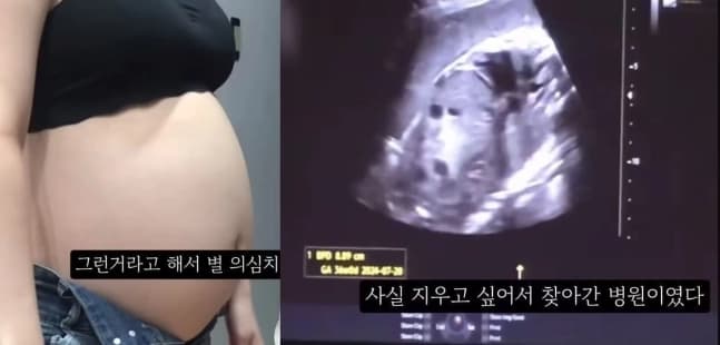 ‘36주차 낙태’ 경찰 “엄중수사”·전문가 “살인죄 가능성”…단순 ‘비만’ 가능성도 이미지