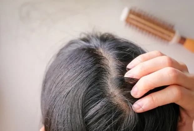 "탈모 고민에 약 먹다가…" 치과의사 면허 정지된 사연 이미지
